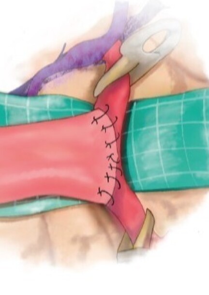 Vascular Dissection Techniques and Microanastomosis Course - Formazioni