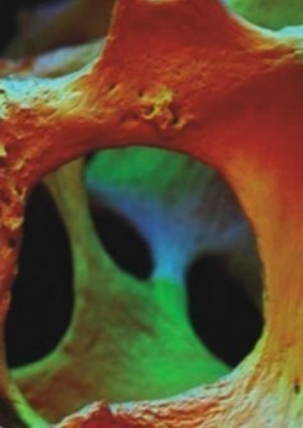 Symposium de « L’ostéoporose au quotidien » le 5 février 2026 - Formations