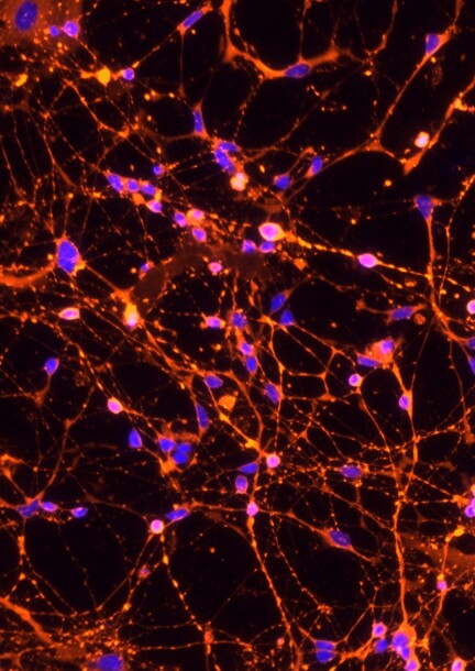 10ème Journée Romande Neuroimmunologie Clinique - Conférences - Auditoire Jequier Doge, CHUV
