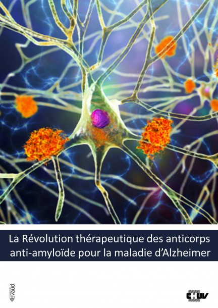 La Révolution thérapeutique des anticorps anti-amyloides pour la maladie d'Alzheimer - Conférences - Auditoire César Roux - CHUV